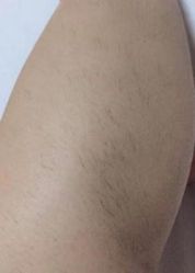 -东莞西妃整形美容医院