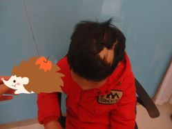 点击看大图 -碧莲盛·不剃发植发