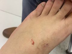 -新甲连锁灰指甲·甲沟炎·鸡眼(黑龙江路店)