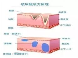 -上海漾颜医疗美容