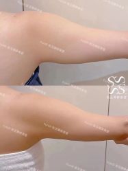 -Fundi张玉珊修身堂·indiba·BTL科技瘦身