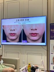 -广州美莱医疗美容医院