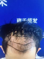 -雍禾植发全国连锁