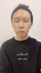 -联合丽格·张菡丽格医疗美容
