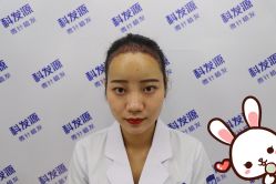 点击看大图 -大麦微针植发丨全国连锁