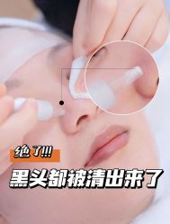 -SKIN79皮肤管理中心