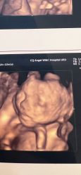 -重庆安琪儿妇产医院-妇幼保健联盟医院