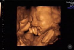 -郑州万安妇产医院