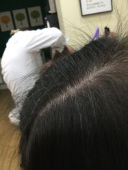 -菩叶脱发白发中心
