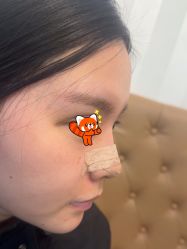 体验后-深圳广和门诊部·整形医疗美容