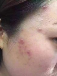 英树玻尿酸羊胎素化妆品-英树玻尿酸羊胎素专营化妆品