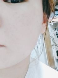 点击看大图 体验后-南京康美美容医院·旗舰店