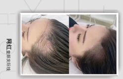 -慕拉美甲美睫皮肤管理