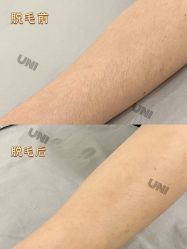 -ANRI安里·专业男士脱毛连锁