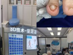 -Andrew指甲专科灰指甲·甲沟炎矫正·3D步态矫形鞋垫定制(上海法华镇路旗舰店)