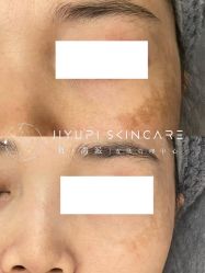 点击看大图 -MLP美丽派·问题肌疗愈中心