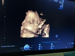 -杭州贝瑞斯美华妇儿医院·早孕·产检·儿科