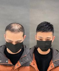 -唐风采假发补发定制