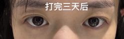 -杭州奥拉克医疗美容门诊部