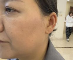 -长沙雅美医疗美容医院