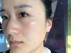 点击看大图 -广州美莱医疗美容医院