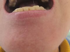 -极光口腔·矫正种植修复(锦江院区)