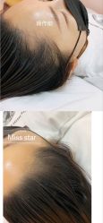 -MISS STAR·半永久纹眉·发际线·美瞳线