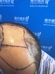 -雍禾植发全国连锁