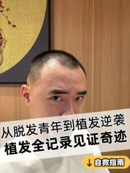 -雍禾植发全国连锁