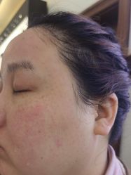-长沙雅美医疗美容医院