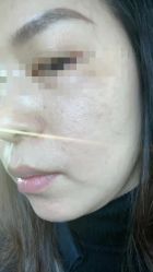 -媛音医美