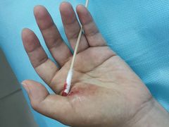 -广州市南沙区中医医院(珠江院区)