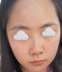 体验后-上海首尔丽格医疗美容医院