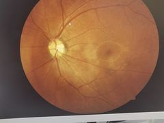 -宝岛眼镜(苏州浒关店)