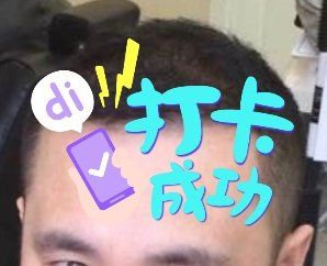 -大麦微针植发全国连锁