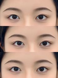 点击看大图 -杨益美学·野生眉半永久纹眉发际线