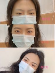 -久匠·纹眉纹绣半永久