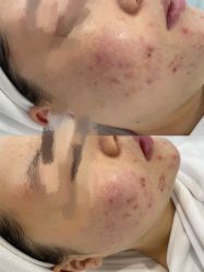 -SKIN79皮肤管理中心