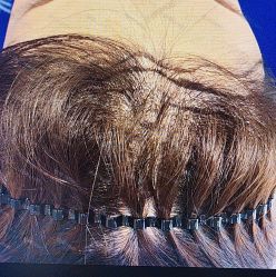 -雍禾植发全国连锁