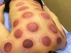 -理疗君·古法推拿姜疗SPA馆(东门店)