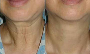 点击看大图 -SKINIST丽铂医疗美容