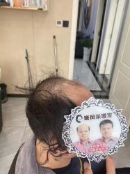 -唐风采假发补发定制