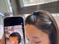 -碧莲盛·不剃发植发