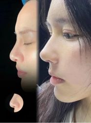 -上海伊莱美医疗美容医院