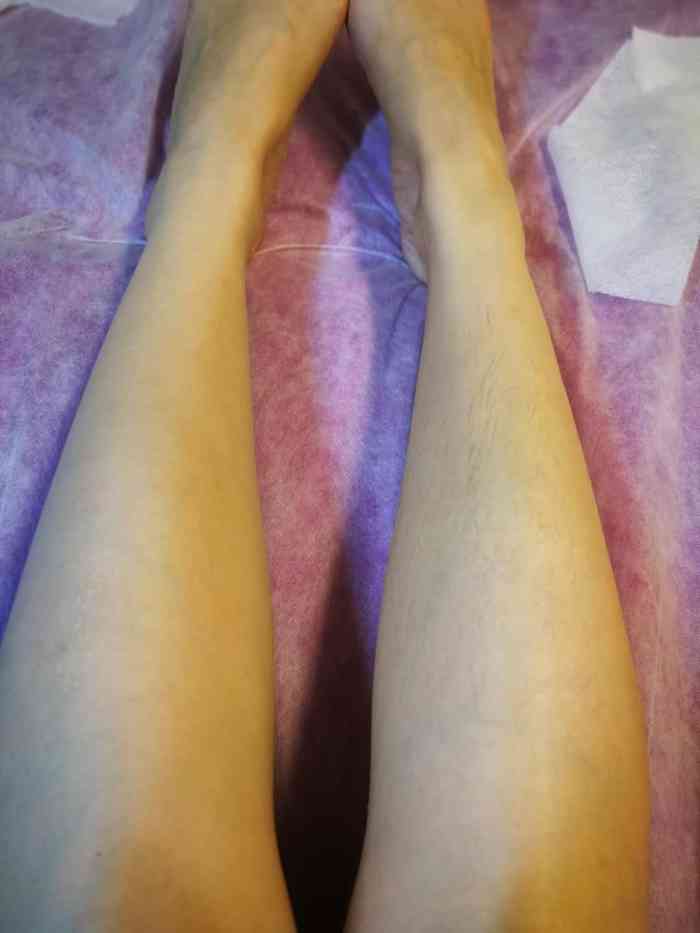 巴西热蜡比基尼脱毛 - carezza-"dora人美技术好 下手快准狠 绝对是我