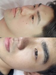 -清疣美疣·痣·斑净肤中心