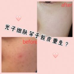 -万州华美紫馨整形美容医院