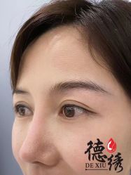 -德绣·机器野生眉发际线·美瞳线半永久