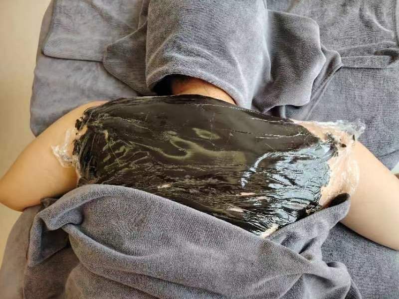 宝妈敷中药泥灸肩颈以后排出来的湿寒,泥灸