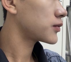 体验后-上海首尔丽格医疗美容医院